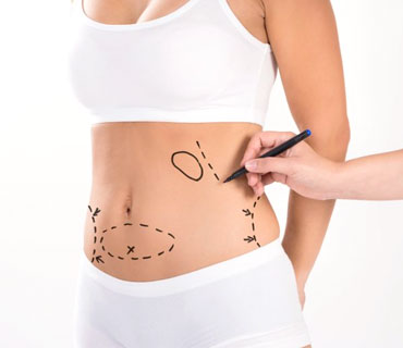 Mommy Makeover - Post-Pregnancy Restoration